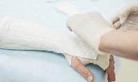 Лечение переломов костей рук в Ижевске